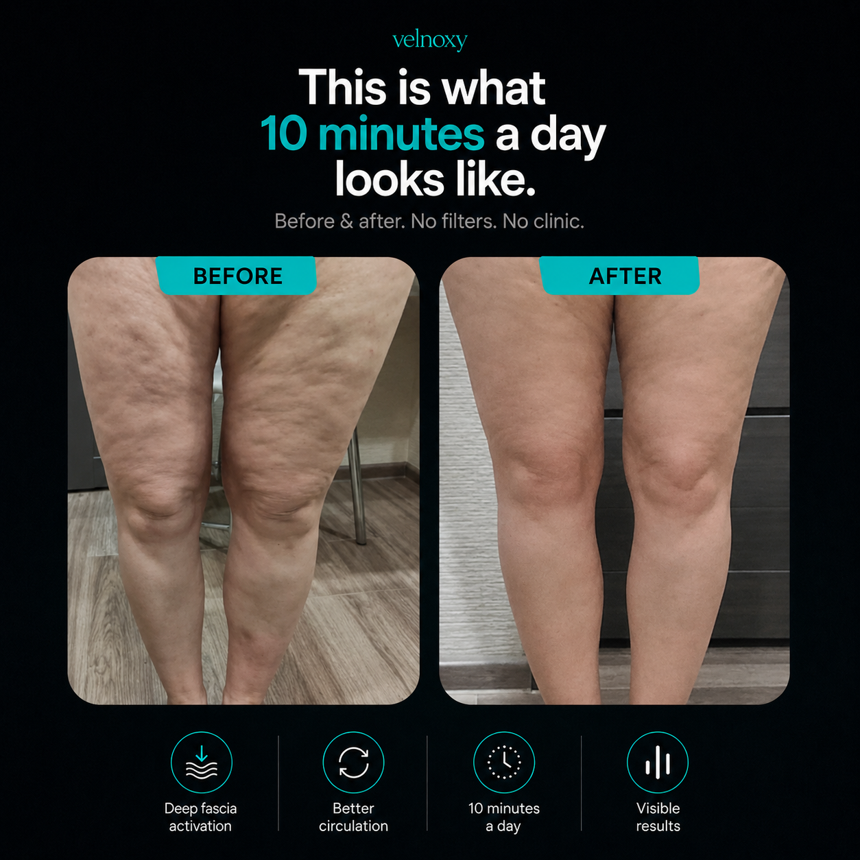 Velnoxy™ Deep-Tissue Anti-Cellulite Massager